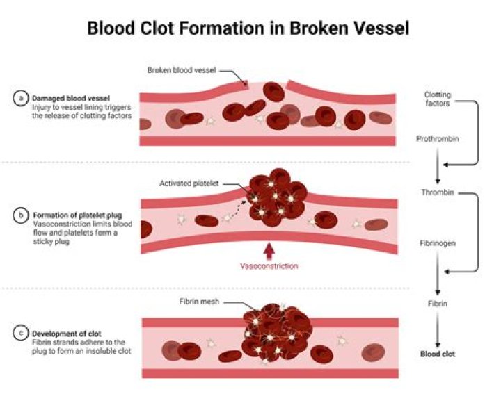 Can blood clot in zero gravity?