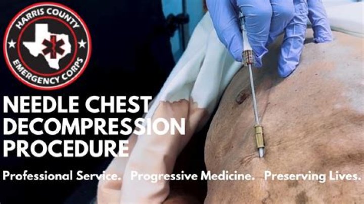 Can EMTs do needle decompression?