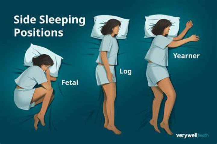 Can I sleep on my side with a catheter?