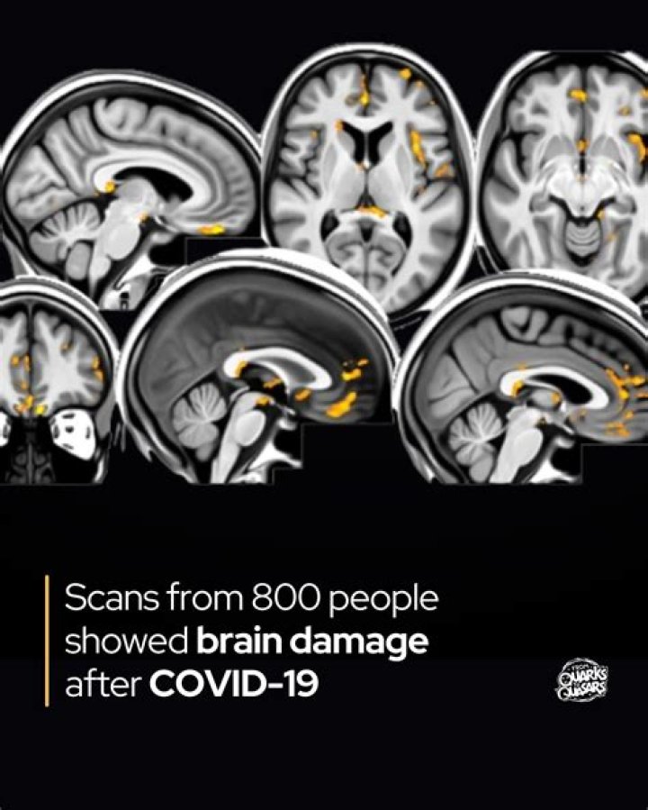Can VR damage your brain?
