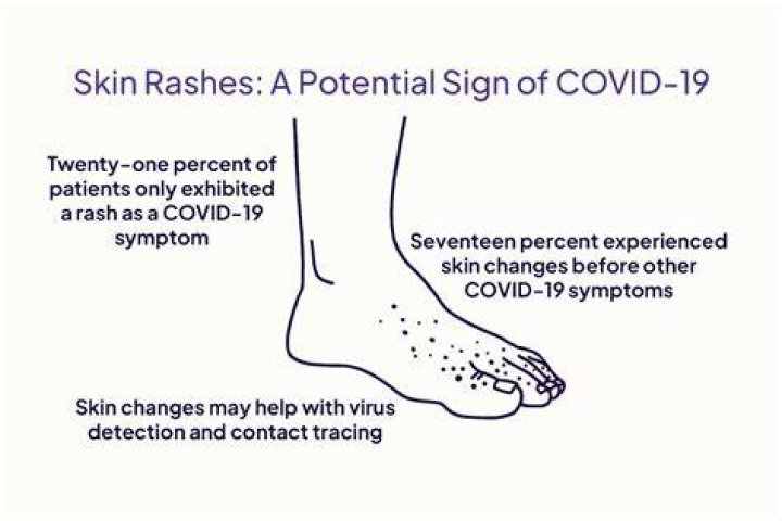 Does Covid make your skin hurt?