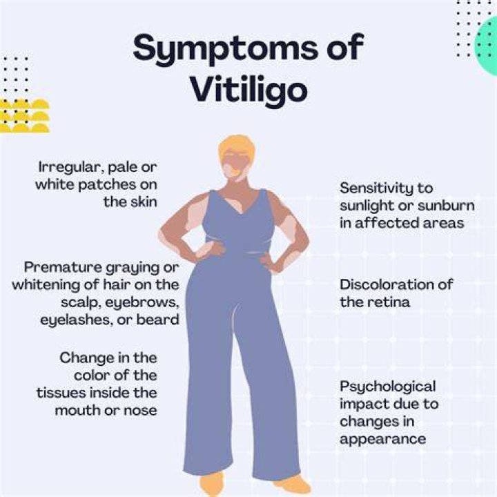 Does vitiligo cause headaches?