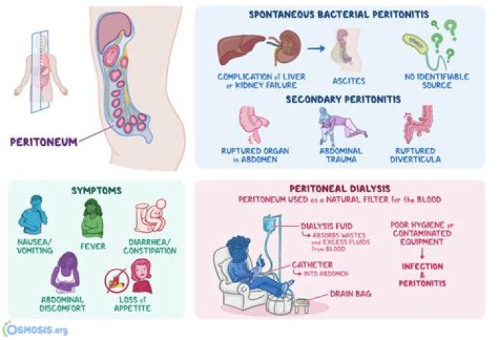 What causes dog peritonitis?