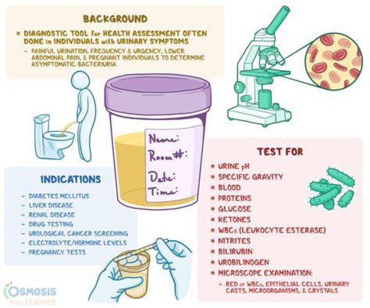 Will a urine test show kidney disease?